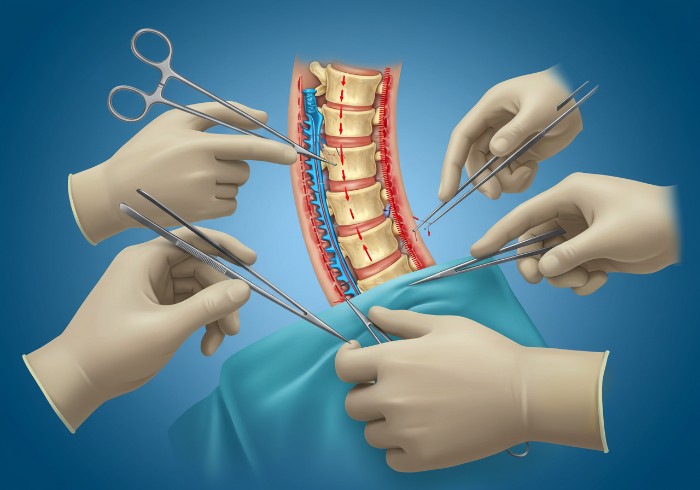 grow-taller-surgery-1